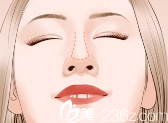 鼻尖輪廓圖