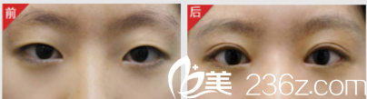 北京米蘭柏羽麗都醫(yī)療美容醫(yī)院案例
