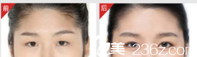北京米蘭柏羽麗都醫(yī)療美容醫(yī)院案例