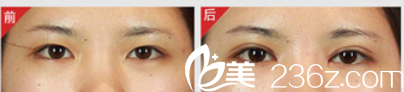 北京米蘭柏羽麗都醫(yī)療美容醫(yī)院案例