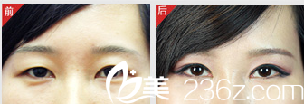 北京米蘭柏羽麗都醫(yī)療美容醫(yī)院案例