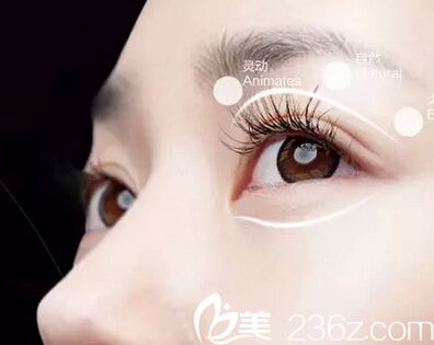 雙眼皮手術(shù)的成型階段