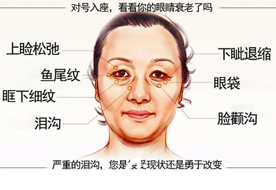 眼袋    眼部問(wèn)題