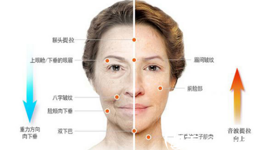 四川達(dá)州雙均整形美容醫(yī)院廖書(shū)艷醫(yī)生對(duì)面部除皺手術(shù)的講解