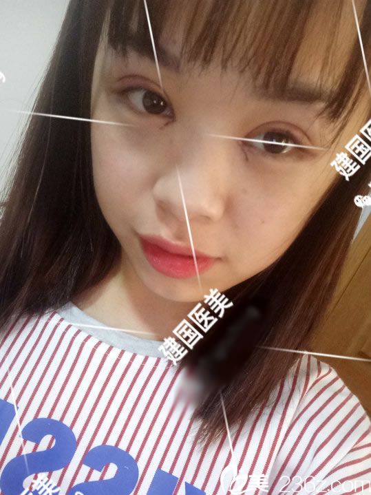 20171123_1511408758768218.jpg 0021.jpg