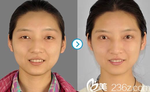 馮守運<span style=