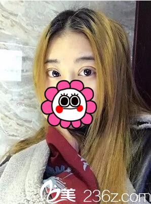 7天后拆線 7天后拆線