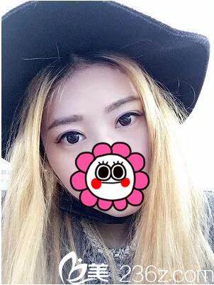 術(shù)后15天效果 術(shù)后15天效果