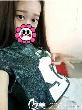 術(shù)前眼睛情況 術(shù)前眼睛情況