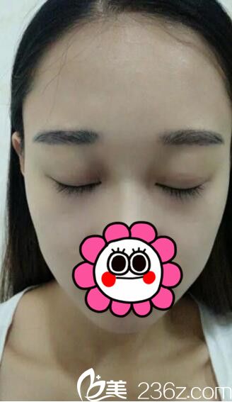 閉眼效果 閉眼效果