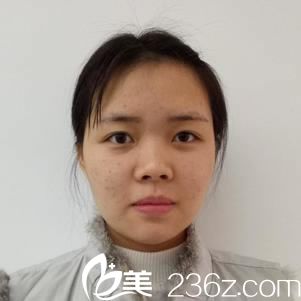 金華瑞麗門診部劉政術(shù)前照片1