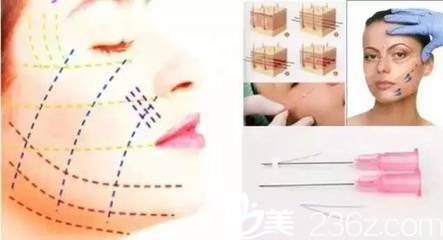 線雕是很符合如今當代的潮流