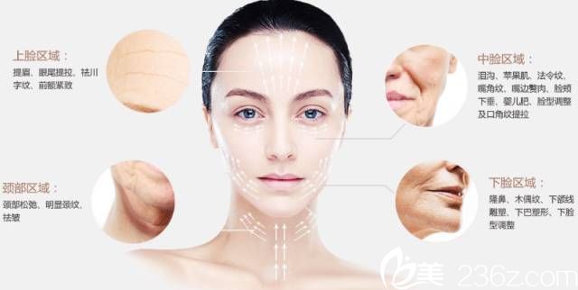 25歲以后都可以做線雕