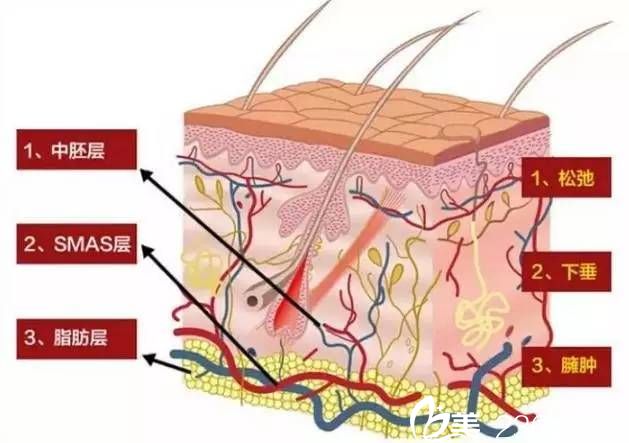 年紀越大做線雕的效果越好