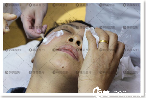 激光操作后冰敷 贛州韓美整形 激光操作后冰敷 贛州韓美整形
