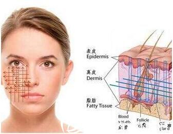 西安美萊醫(yī)學美容醫(yī)院蛋白線原理