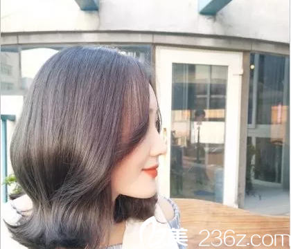 談?wù)剋ill鼻整形怎么樣？一個(gè)鼻綜合真人案例從此不再遭受丑拒