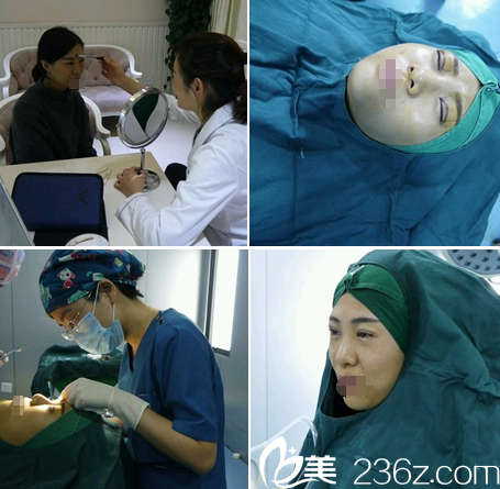 術前面診設計手術方案及術后即刻效果