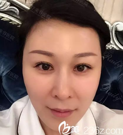 杭州瑞麗做脂肪填充面部20天<span style= 杭州瑞麗做脂肪填充面部20天<span style=