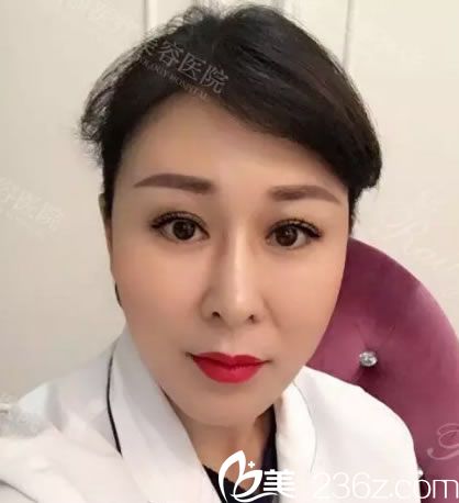 自體脂肪填充心形臉第30天<span style= 自體脂肪填充心形臉第30天<span style=