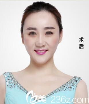 漯河締美儷整形“脂肪面雕+瘦臉+激光祛斑”找回年輕的自己