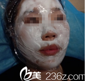 激光祛斑涂麻藥大同美神