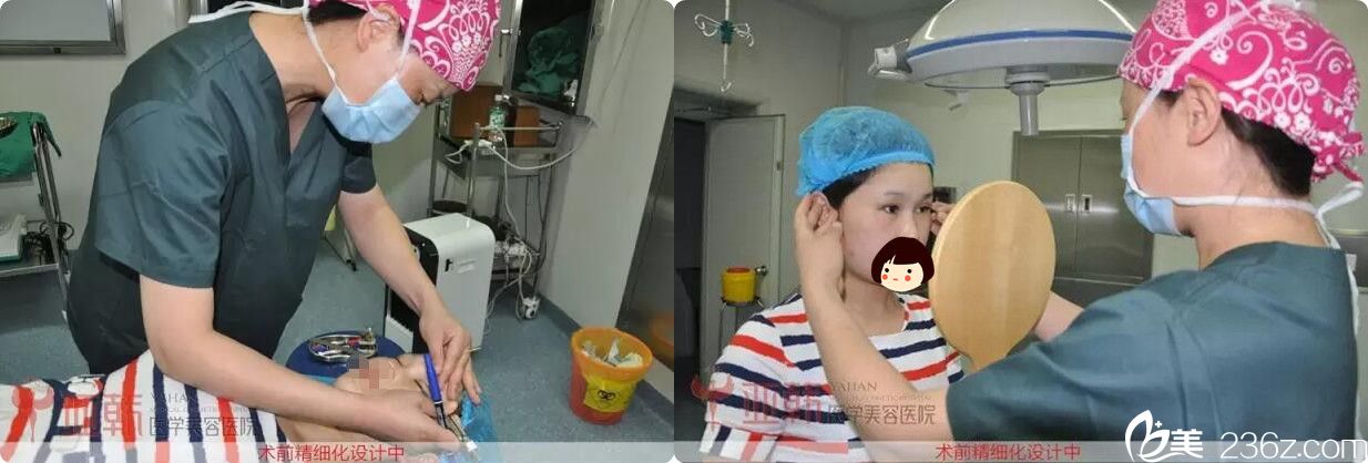 雙眼皮術(shù)前劃線設(shè)計 雙眼皮術(shù)前劃線設(shè)計