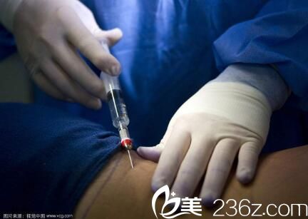 韓國(guó)Topclass整形外科鄭民宇麻醉