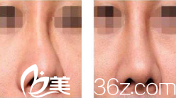韓國秀美顏(TOP FACE)整容外科案例 韓國秀美顏(TOP FACE)整容外科案例