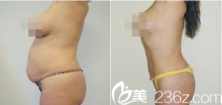 韓國(guó)秀美顏(TOP FACE)整容外科案例 韓國(guó)秀美顏(TOP FACE)整容外科案例