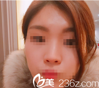 韓國心美眼整形外科醫(yī)院案例 韓國心美眼整形外科醫(yī)院案例