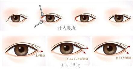 韓國VIEW必嫵整形醫(yī)院金正敏 韓國VIEW必嫵整形醫(yī)院金正敏