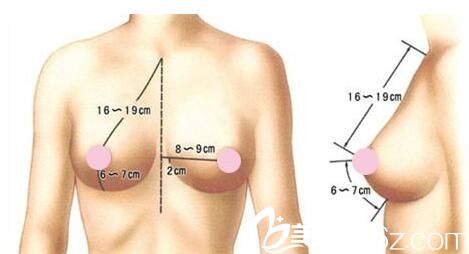 韓國iWell愛我整形外科醫(yī)院正雙平面隆胸 韓國iWell愛我整形外科醫(yī)院正雙平面隆胸