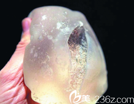 韓國(guó)在敦整形外科隆胸假體