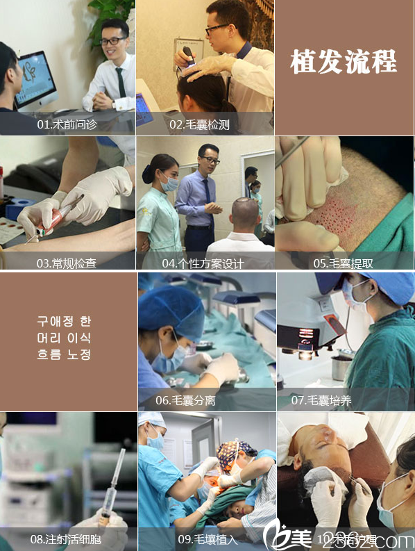 南寧貞韓郝帥院長(zhǎng)植發(fā)流程圖