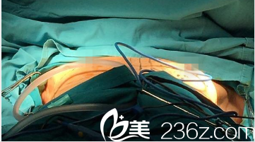 韓國(guó)GOOD LINE崔德浩整形外科案例 韓國(guó)GOOD LINE崔德浩整形外科案例