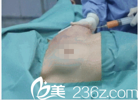 韓國在敦整形外科案例