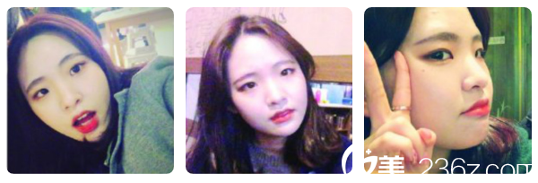 術(shù)前照片 術(shù)前照片