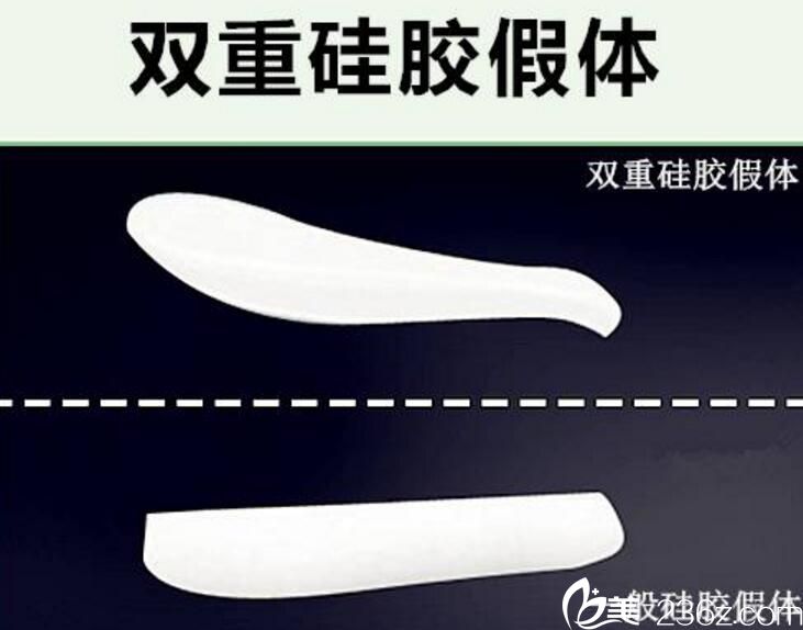 雙重硅膠 那木整形