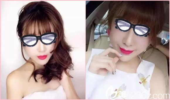 南陽艾美水光注射案例