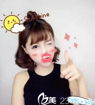 南陽艾美水光注射后7天