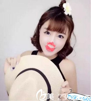 南陽艾美水光注射術(shù)后效果