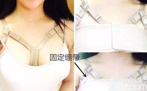 韓國jk整形外科醫(yī)院做隆胸手術(shù)真人案例2