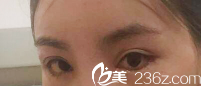 韓國MIGO整形外科醫(yī)院案例 韓國MIGO整形外科醫(yī)院案例