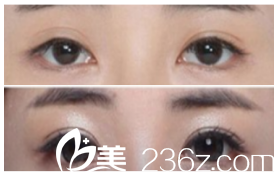 韓國MVP整形醫(yī)院案例 韓國MVP整形醫(yī)院案例