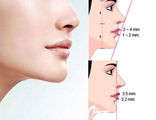 韓國(guó)4月31日完美下巴的標(biāo)準(zhǔn)