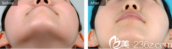 20171221_1513822235217858.png blob.png