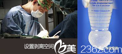 金起甲 韓國(guó)UcanB整形外科醫(yī)院隆胸怎么樣