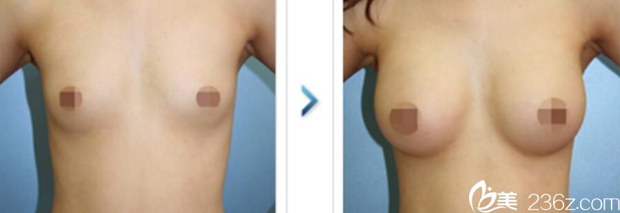 20171221_1513841348187671.jpg 20171221_1513841348187671.jpg