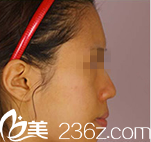 韓國ITEM(愛婷)整形醫(yī)院案例 韓國ITEM(愛婷)整形醫(yī)院案例